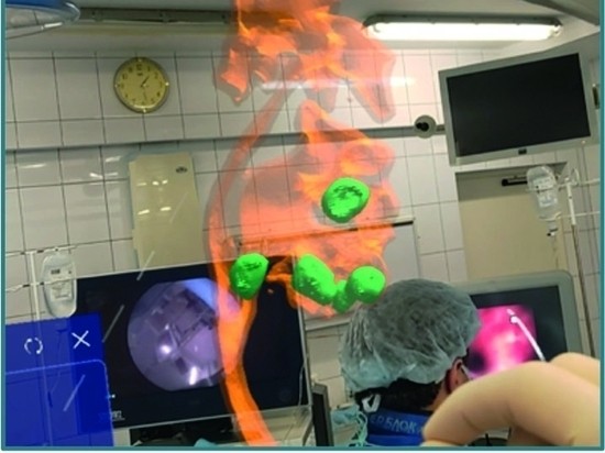 Российские ученые создали смешанную реальность для хирургов