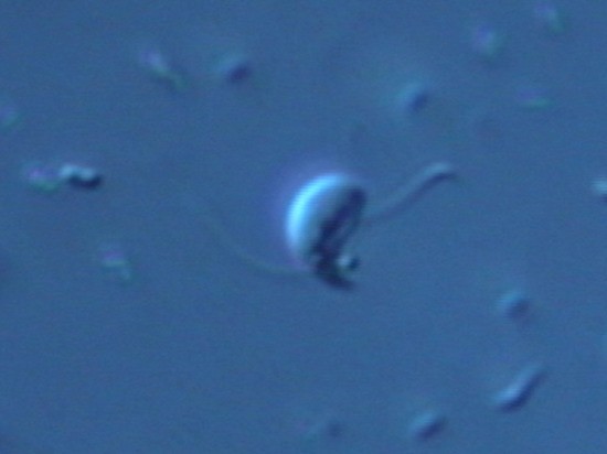 Ученые нашли в Черном море прожорливых агрессивных микрохищников