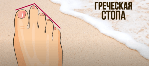 Советы стилиста, как правильно подбирать обувь по полноте и ширине стопы